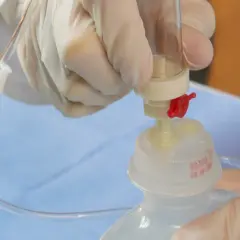 Ręce w rękawiczkach przygotowują kroplówkę, łącząc dren z pojemnikiem. Instrukcja jak podłączyć kroplówkę.