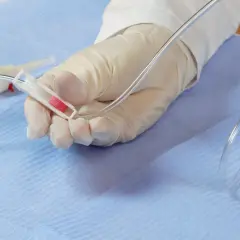 Ręka w rękawiczce przygotowuje się do podłączenia kroplówki do wenflonu, trzymając końcówkę drenu.